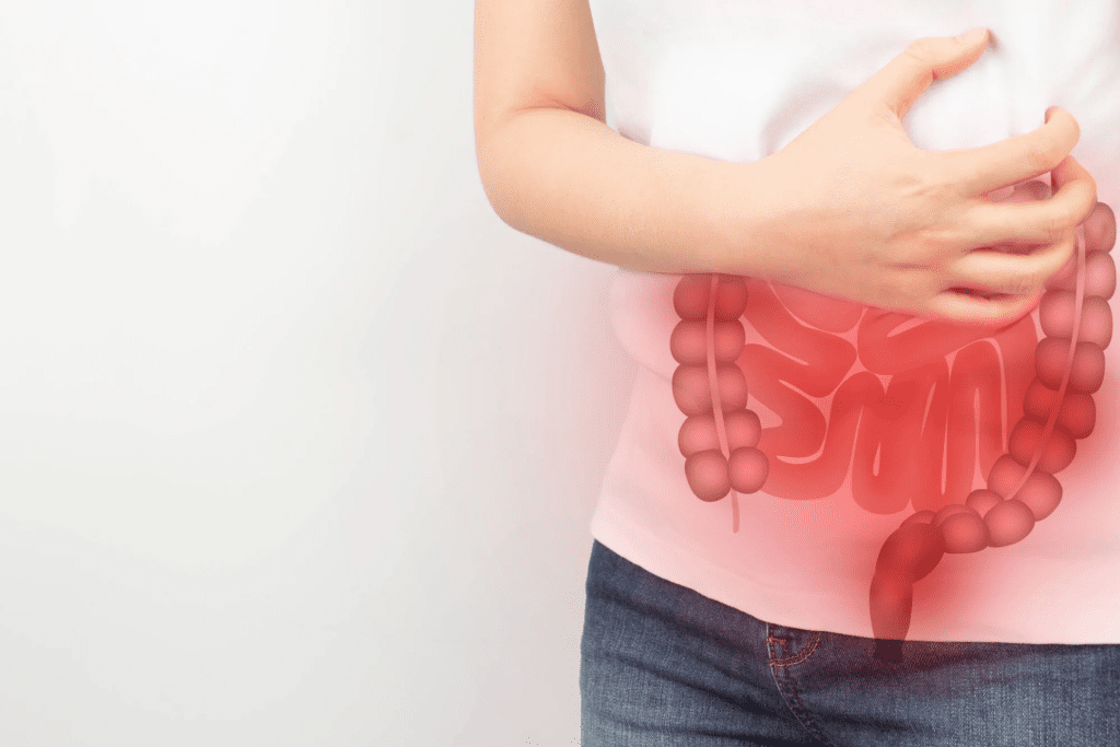 ما هي أعراض التهاب القولون التقرحي؟ وكيفية علاجه؟ 9 التهاب القولون التقرحي