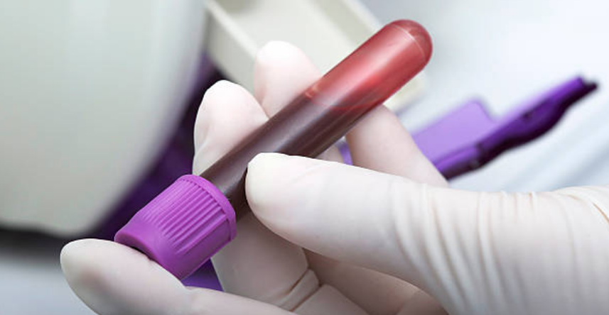 صحة الرجال 9 الفحوصات اللازمة للتأكد من الصحة الجنسية قبل الزواج