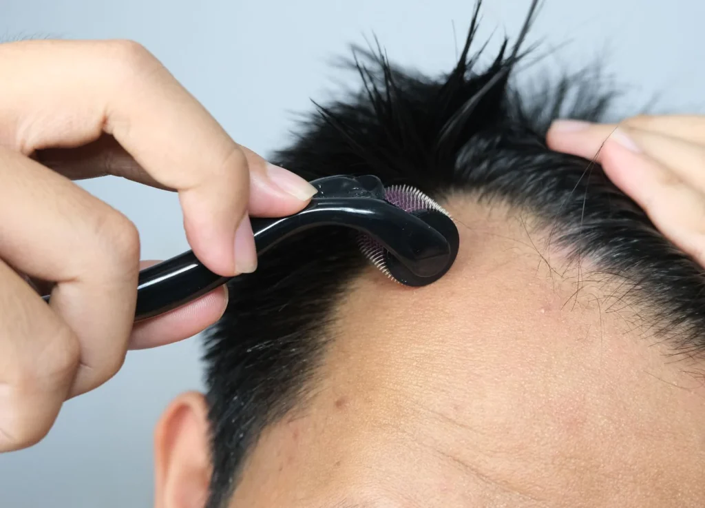 فوائد الديرما رولر للشعر وطريقة الاستخدام الأفضل 2 الديرما رولر للشعر