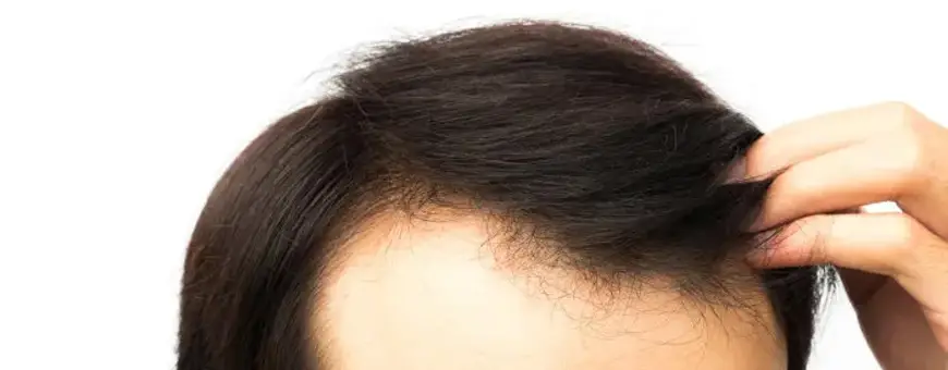 خطوات عملية زراعة الشعر والتقنيات المستخدمة 12 عملية زراعة الشعر