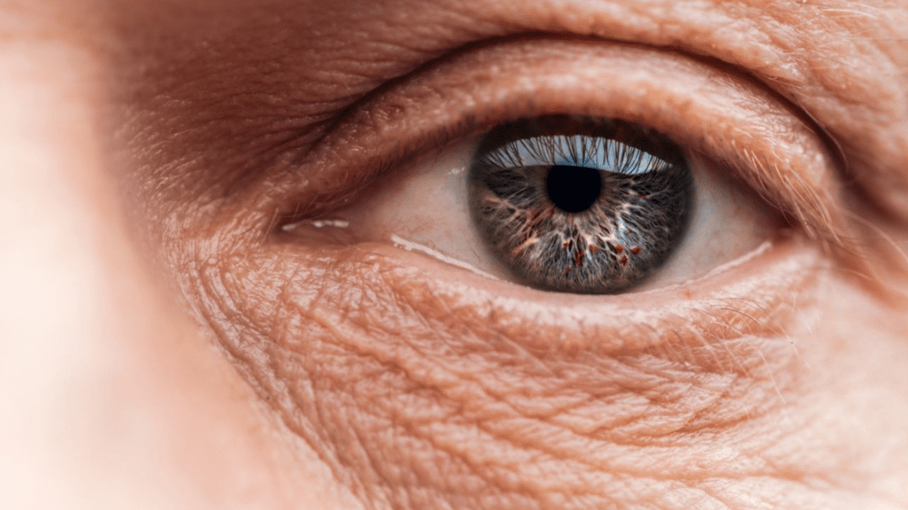 الماء الأبيض في العين