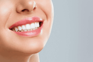 تجميل الاسنان