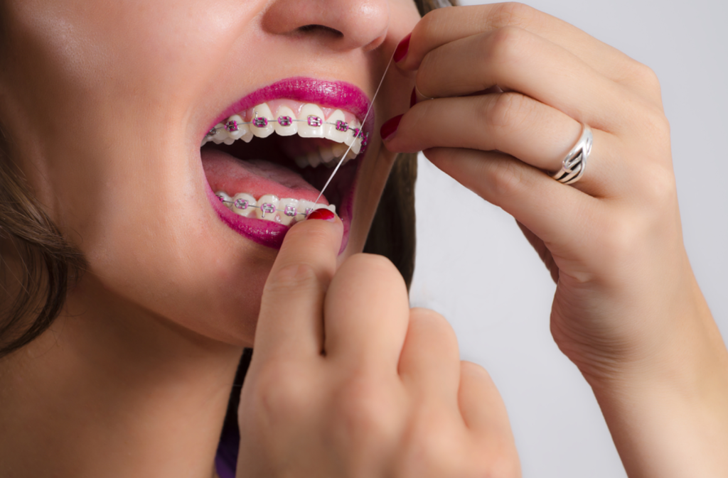 كيفية استخدام خيط تنظيف الأسنان مع تقويم الأسنان 13 خيط تنظيف الأسنان مع تقويم الأسنان