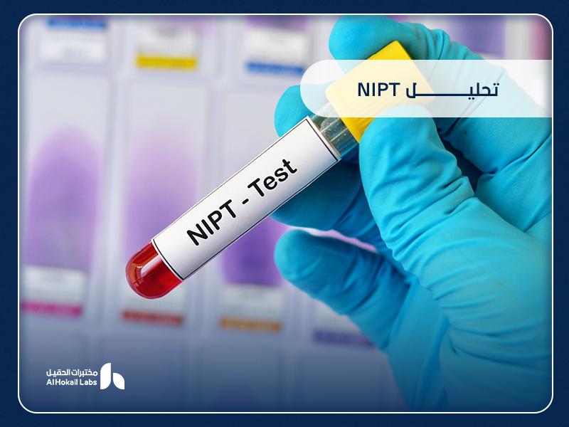 تحليل NIPT: الفحص غير الجراحي الذي يطمئن كل أم على صحة جنينها