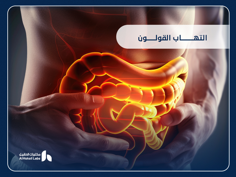 التهاب القولون: أسبابه وأعراضه وطرق التشخيص والعلاج