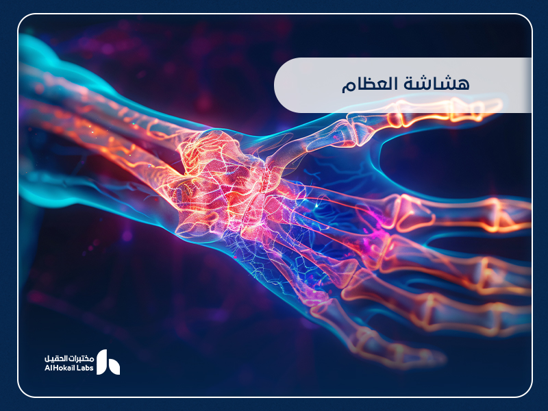 هشاشة العظام: الأسباب والأعراض وطرق التشخيص والعلاج