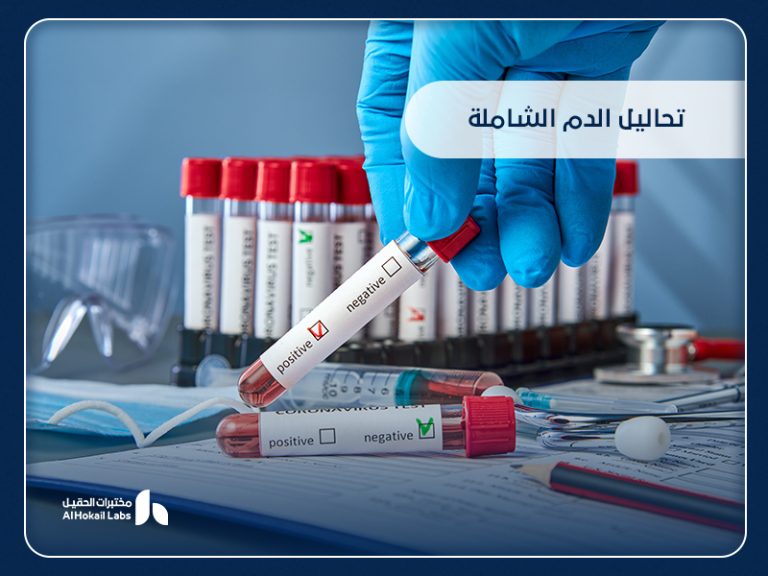 تحاليل الدم الشاملة: دليلك لفهم أهميتها وأماكن إجرائها في السعودية