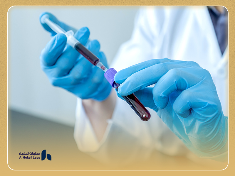 Lab technician handling blood sample