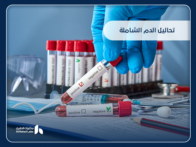 تحاليل الدم الشاملة: دليلك لفهم أهميتها وأماكن إجرائها في السعودية 25 تحاليل الدم الشاملة: دليلك لفهم أهميتها وأماكن إجرائها في السعودية