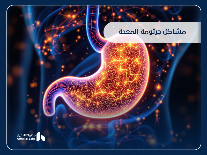 مشاكل جرثومة المعدة: الأسباب والأعراض وطرق التشخيص والعلاج
