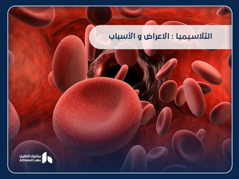 الثلاسيميا: الأعراض والأسباب وطرق التشخيص من مختبرات الحقيل