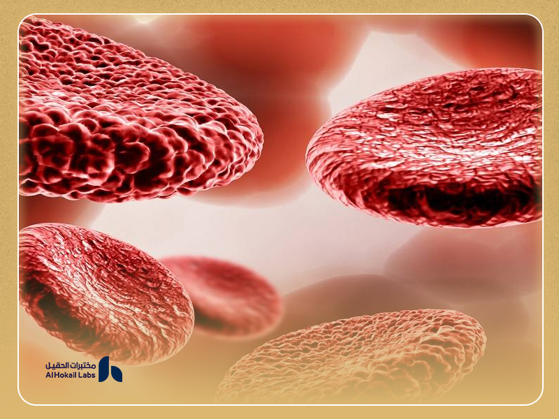 الثلاسيميا: الأعراض والأسباب وطرق التشخيص من مختبرات الحقيل 1 ما الفرق بين الثلاسيميا الصغرى والثلاسيميا الكبرى؟