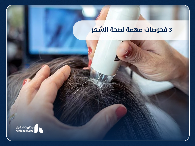 صحة الشعر: الفحوصات والتحاليل التي تكشف أسرار جمال شعرك من مختبرات الحقيل
