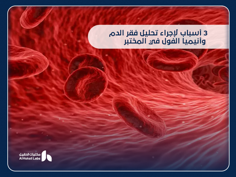 فقر الدم وأنيميا الفول: الأسباب، الأعراض، وطرق التشخيص من مختبرات الحقيل 28 فقر الدم وأنيميا الفول: الأسباب، الأعراض، وطرق التشخيص من مختبرات الحقيل