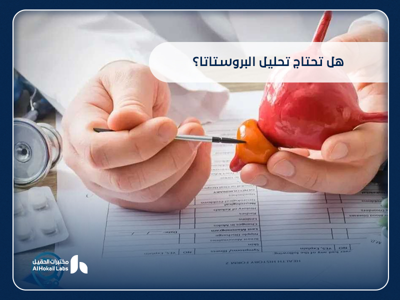 البروستاتا: الأعراض، الفحوصات، وأهمية التحليل المبكر في مختبرات الحقيل 25 البروستاتا: الأعراض، الفحوصات، وأهمية التحليل المبكر في مختبرات الحقيل