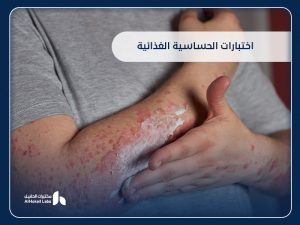 اختبارات الحساسية الغذائية: دليلك الكامل من مختبرات الحقيل في السعودية