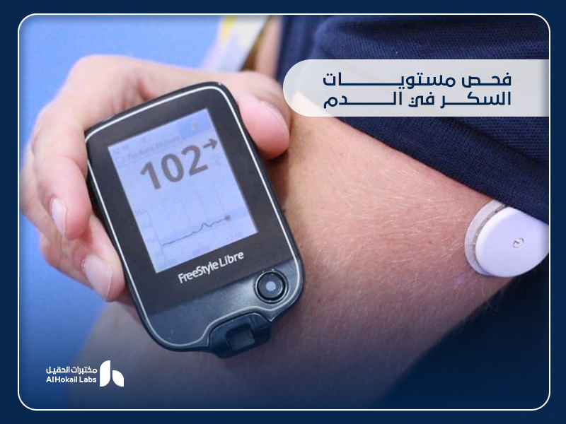 فحص مستويات السكر في الدم: دليلك الكامل لفهم التحاليل وأماكن إجرائها في السعودية 19 فحص مستويات السكر في الدم: دليلك الكامل لفهم التحاليل وأماكن إجرائها في السعودية