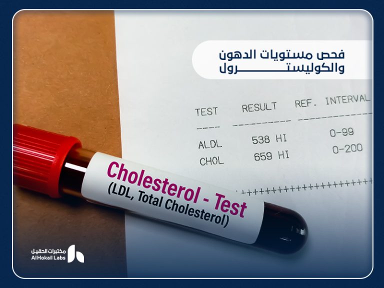 فحص مستويات الدهون والكوليسترول: دليلك الشامل لإجرائه في السعودية