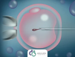 الحقن المجهرى